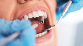 Soins dentaires : Baisse des remboursements dès octobre