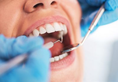 Soins dentaires : Baisse des remboursements dès octobre